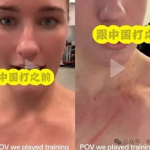恶人先告状!澳洲女球员爆料被抓伤,中国队长晒照霸气回怼