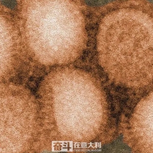 意大利出现首例澳洲流感住院病例 该病毒将严重影响人类大脑